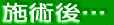 施術後…